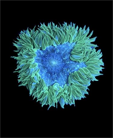 WYSIWYG Ultra Rock Flower Anemone 2.5"